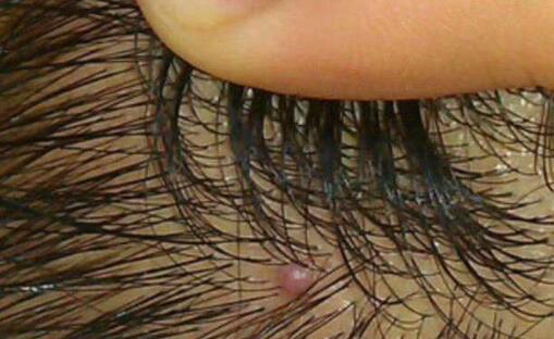ݷƤҽԺ